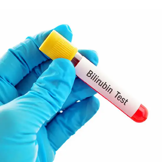 serum bilirubin indirect test